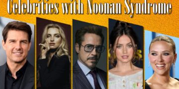 Celebrities with Noonan Syndrome: Inspiring Tales of Resilience and Triumph